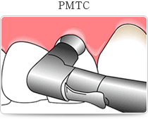 PMTC