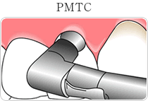 PMTC